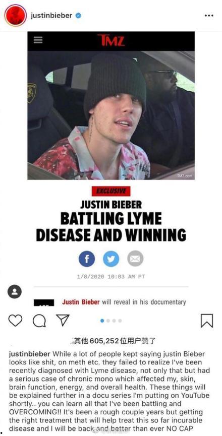 比伯管家爆料视频,独家爆料视频背后的惊人真相